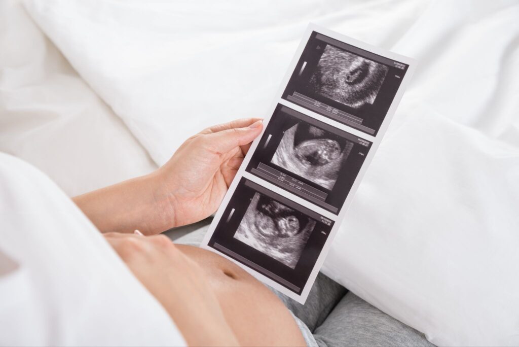 エコー写真を見てお腹を撫でている妊婦