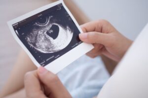 心拍確認はいつ？胎嚢確認からの流れや見えないケースなどを解説